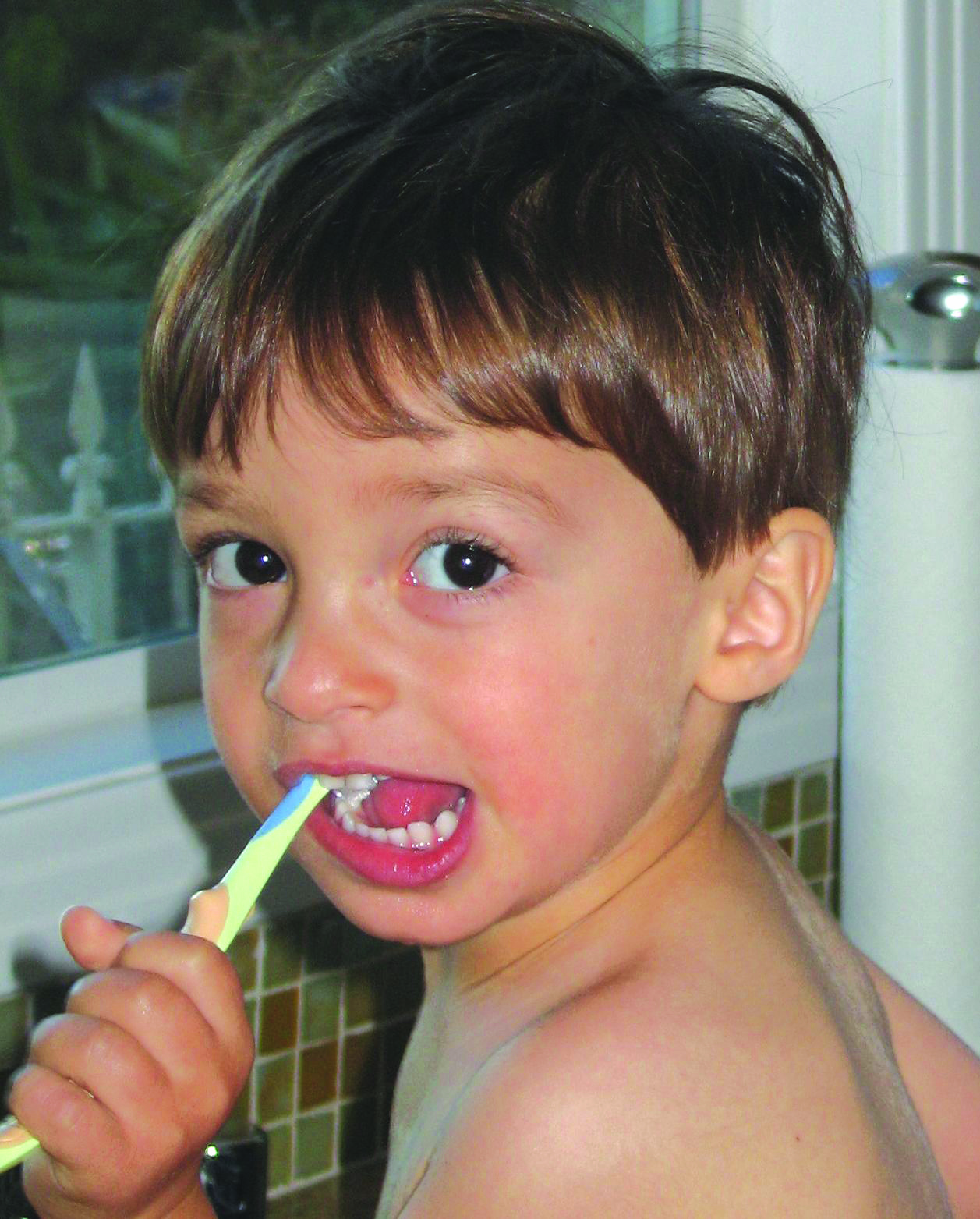 تعرفى على اسباب تسوس اسنان الاطفال وكيف يمكن الوقاية منة