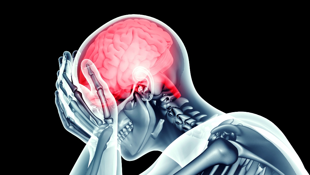 علامات خطيرة للسكتة الدماغية تهدد الشباب أيضا