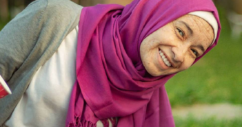 مصرية تعاني من مرض يجعلها أكبر بـ3 عقود