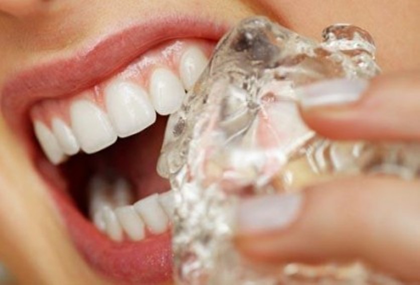 هذه 6 طرق منزلية للحد من حساسية الأسنان