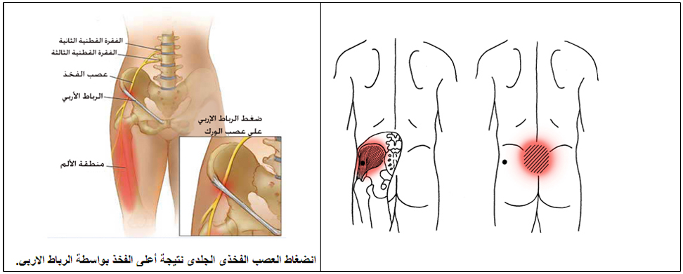 هل تعاني من آلام أسفل الظهر؟ الوقاية والعلاج